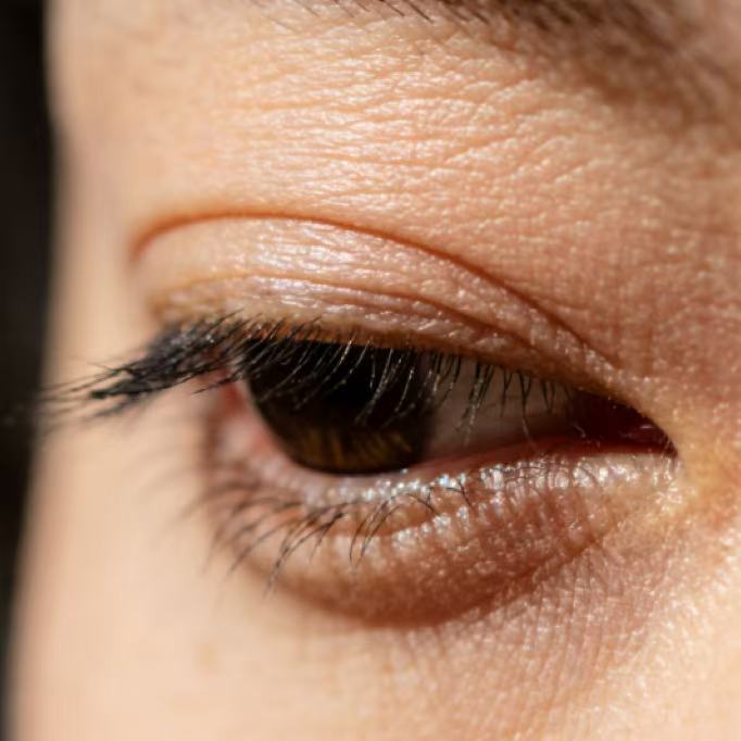 秋冬眼周护理大作战，hfp冷玛吉眼油守护你的年龄秘密